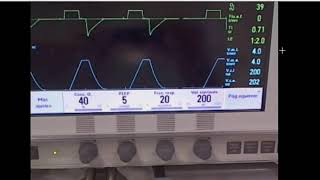 Taller de fisiología respiratoria