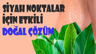 SİYAH NOKTALARA ETKİLİ DOĞAL ÇÖZÜM- SİYAH NOKTALAR NASIL GEÇER