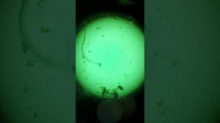 Strongyloides stercoralis worm under the microscope #science #microscope #biology