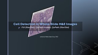 Cell Detection in Whole Slide H&E Images [FIJI-StarDist, QuPath-ImageJ, QuPath-StarDist]