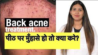 Back Acne Treatment | How to get rid of back acne | पीठ के पिमपलस का इलाज