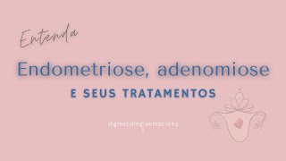 Endometriose, adenomiose e seus tratamentos