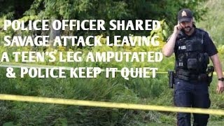 #DOGMAN, POLICE OFFICER SHARES SAVAGE ATTACK LEAVING A TEEN'S LEG AMPUTATED,  POLICE KEEP IT QUIET