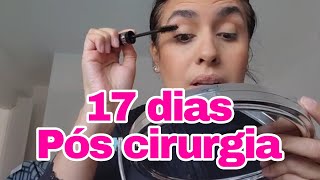 17 DIAS DE CIRURGIA DE ABDOMINOPLASTIA: TOMEI BANHO E ME ARRUMEI SOZINHA PARA A CONSULTA MÉDICA