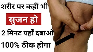 शरीर पर कहीं भी सूजन हो 1 Point दबाने से ठीक होगी | How To Cure Body Swelling At Home| Sujan ka ilaj