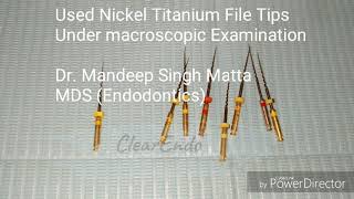 Used Endodontic Nickel Titanium Files Under MACRO LENS