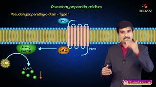 Pseudohypoparathyroidism : Part 1 : Pathology