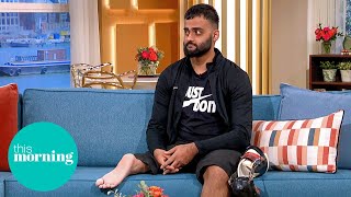 ‘I Had My Leg Amputated and My Foot Sewn On Backwards’ | This Morning