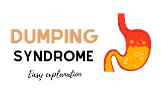 Dumping Syndrome