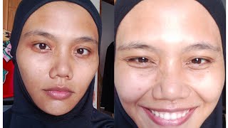 Sebelum dan Sesudah Pakai Skincare Mama's Choices