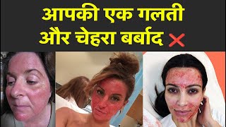 Facial In Pigmentation Dr Prateek chauhan