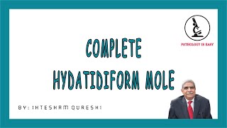 Complete Hydatidiform Mole (Female Genital Tract)