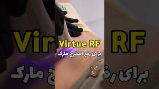 درمان استرچ مارک با virtue rf