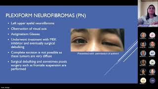 Pediatric Manifestations of Neurofibromatosis Type 1  Pediatric Grand Rounds Meeting 11 15 24