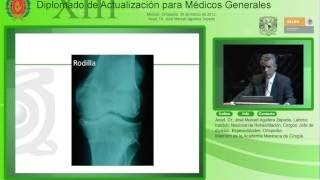 Tratamiento quirúrgico de la osteoartritis Acad. Dr. José Manuel Aguilera Zepeda 202017