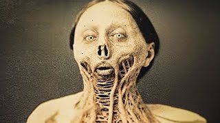 7 Most TERRIFYING Diseases In History