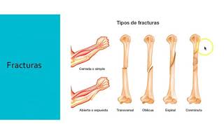 Sistema Musculoesquélico 2