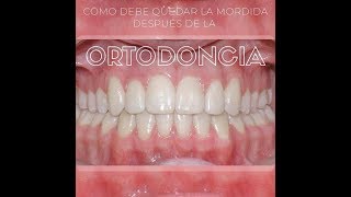 COMO DEBE QUEDAR LA MORDIDA LUEGO DE LA ORTODONCIA