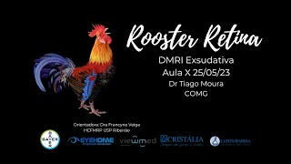 DMRI Exsudativa - Dr Thiago Moura COMG