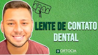 Depoimento Matheus Cassalho Sobre sua Lente de Contato Dental