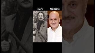 Bollywood actors when they lost their hair's 😣 #shorts #viral #trending #bollywoodactor