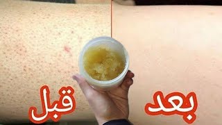 سرخطير لعلاج جلد الوزه✨الدكتور مش عايزك تعرفيه🤯استمتعي ببشرة ناعمه كالاطفال ووفري فلوسك💸