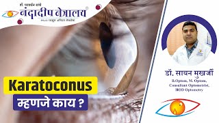 What is Keratoconus - Symptoms, Treatment and More (In Hindi)