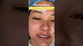 Micro needling at Elite PMU (book with Mehrnoush)