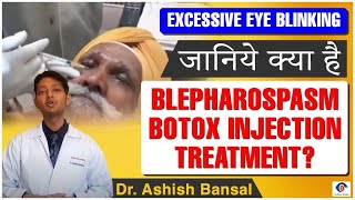 Best Blepharospasm Botox Injection Treatment For Eyes| पलके झपकने का इलाज | Stop Eye Spasms Forever!