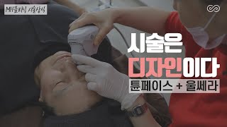 MH시술편 - 시술시 얼굴 디자인이 중요한 이유 [MH클리닉]