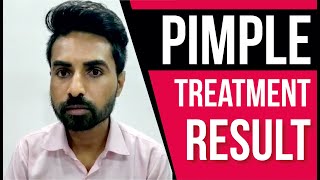 Best Pimple and Pigmentation Treatment | Sakhiya Skin Clinic Review | Testmonial