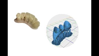 3D Dental Printer