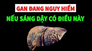 Nếu buổi sáng thức dậy có 4 biểu hiện này Gan của bạn đang nguy hiểm