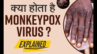 || Monkeypox Virus Alert: कोरोना के बाद ये खतरनाक वायरस मचा रहा तबाही! ICMR ने जारी किया अलर्ट ||