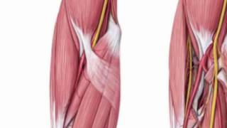 Case 1 (Thymoma / PCIS) Intro with Anatomy