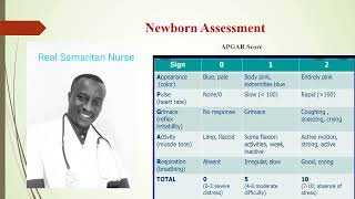 APGAR score: Menya Uko basuzuma umwana ukivuka