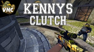 CS:GO - kennyS Clutch x TSM [IEM Gamescom 2015 Final]