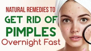 How To Remove Pimples OVERNIGHT || Natural Remedies for Pimples 2017 || What It Takes