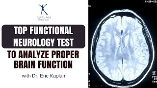 Top Functional Neurology Test to Analyze Proper Brain Function