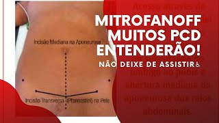 MITROFANOFF - Muitos Pcd entenderão! Não deixe de assistir @SilvinhoSobreRodas