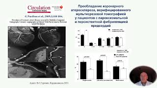 Роль атеросклероза в аритмогенезе