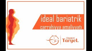 ideal bariatrik cərrahiyyə əməliyyatı varmi