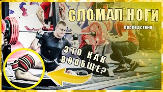 СЛОМАЛ НОГИ ПОД ШТАНГОЙ - ЧТО ДАЛЬШЕ?