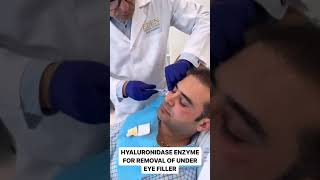 Hyaluronidase Enzyme for Under-Eye Filler Removal | EDEN AESTHETICS Clinic Dubai