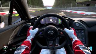 Something a little Different - Project Cars Gameplay