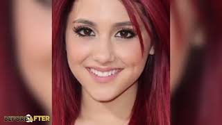 Ariana Grande   Before & After   Transformation  Hair, Plastic Surgery, Make Up & More