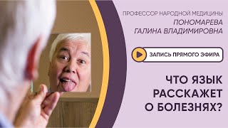 ⚡️ЭФИР: ЧТО ЯЗЫК РАССКАЖЕТ О БОЛЕЗНЯХ?⚡️