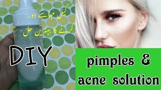 BEST TREATMENT OF PIMPLES AND ACNE | DIY FACE WASH | URDU /HINDI /ENG SUB