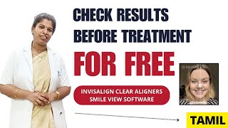 Invisalign smile view inaguration | Thanjai Dental Centre #thanjavur #dentalcare #invisalign