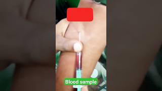 Blood sample #shortvideo #youtubeshorts #trendingshorts #motivation #newvideo #medical #bloodsample